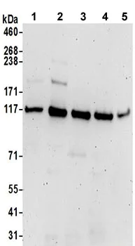 Western blot - Anti-ARS2 antibody - N-terminal (AB192999)