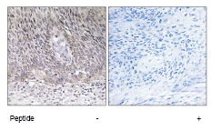 Immunohistochemistry (Formalin/PFA-fixed paraffin-embedded sections) - Anti-ARSA/ASA antibody (AB74804)