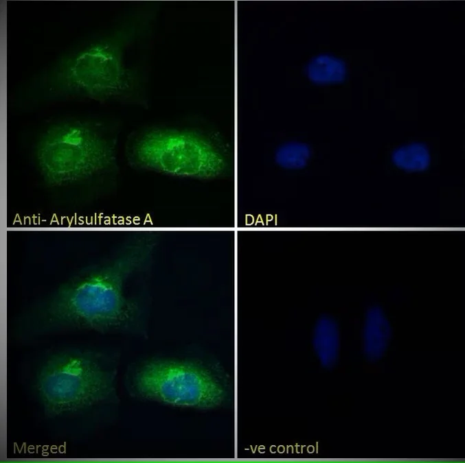 Immunocytochemistry - Anti-ARSA/ASA antibody (AB77586)