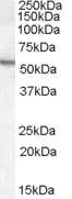 Western blot - Anti-ARSA/ASA antibody (AB77586)