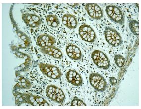 Immunohistochemistry (Formalin/PFA-fixed paraffin-embedded sections) - Anti-ARSA/ASA antibody [EPR11039] (AB174844)