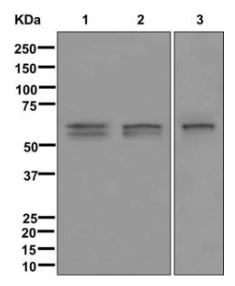 Western blot - Anti-ARSA/ASA antibody [EPR11039] (AB174844)