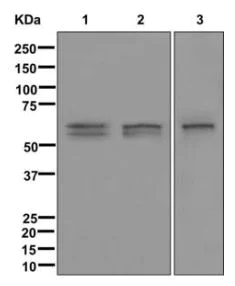 Western blot - Anti-ARSA/ASA antibody [EPR11039] - BSA and Azide free (AB249832)