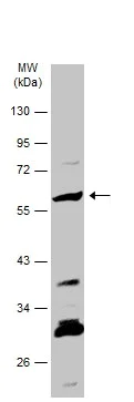 Western blot - Anti-ARSB antibody (AB228018)