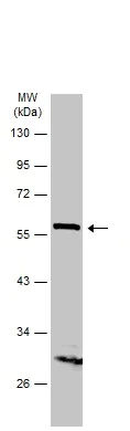 Western blot - Anti-ARSB antibody (AB228018)