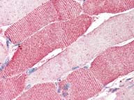 Immunohistochemistry (Formalin/PFA-fixed paraffin-embedded sections) - Anti-ARSB antibody (AB85727), expandable thumbnail