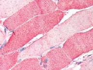 Immunohistochemistry (Formalin/PFA-fixed paraffin-embedded sections) - Anti-ARSB antibody (AB85727)