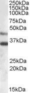 Western blot - Anti-ARSB antibody (AB85727)