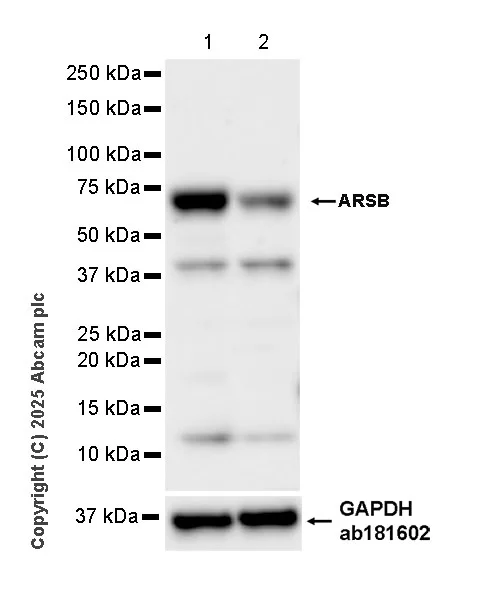 Western blot - Anti-ARSB antibody [EPR29282-12] - BSA and Azide free (AB326588)