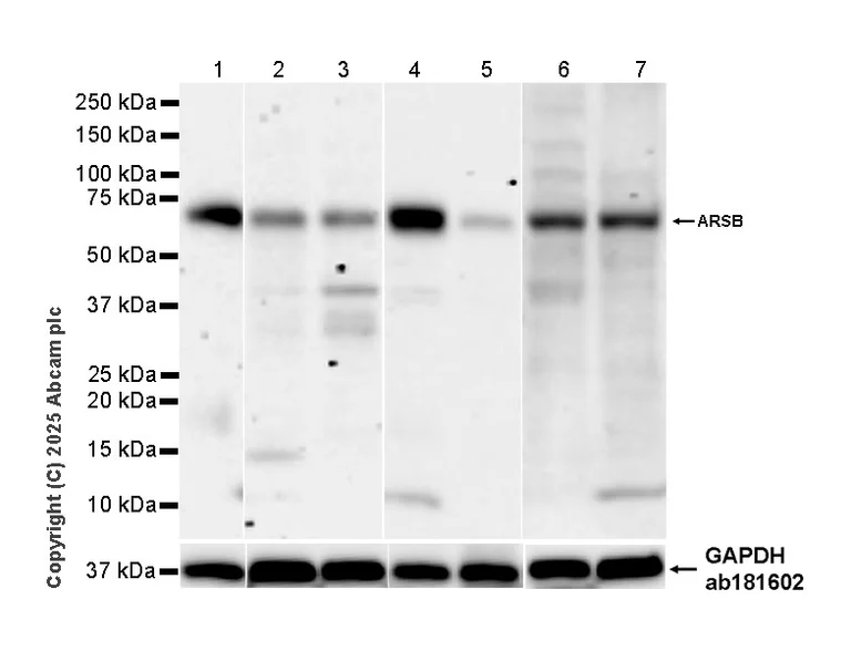 Western blot - Anti-ARSB antibody [EPR29282-12] - BSA and Azide free (AB326588)