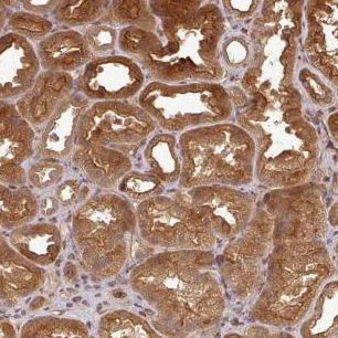 Immunohistochemistry (Formalin/PFA-fixed paraffin-embedded sections) - Anti-ART1 antibody (AB185293)