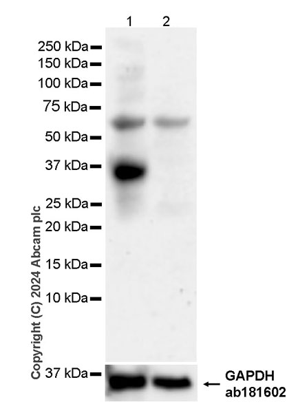 Western blot - Anti-ART1 antibody [EPR28754-56] - BSA and Azide free (AB316160), expandable thumbnail