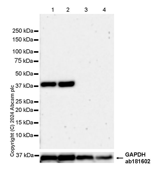 Western blot - Anti-ART1 antibody [EPR28754-56] - BSA and Azide free (AB316160), expandable thumbnail