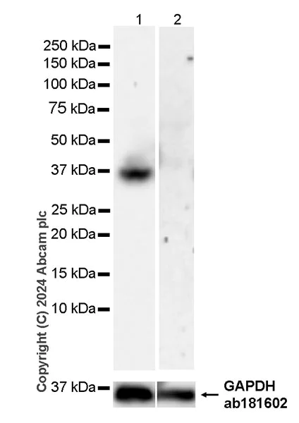 Western blot - Anti-ART1 antibody [EPR28754-56] - BSA and Azide free (AB316160)