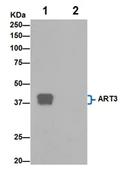 Immunoprecipitation - Anti-ART3 antibody [EPR7220(2)] - BSA and Azide free (AB251155)