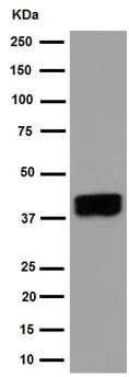 Western blot - Anti-ART3 antibody [EPR7220(2)] - BSA and Azide free (AB251155)