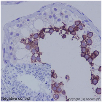 Immunohistochemistry (Formalin/PFA-fixed paraffin-embedded sections) - Anti-ART3 antibody [EPR7220(2)] - C-terminal (AB192870)