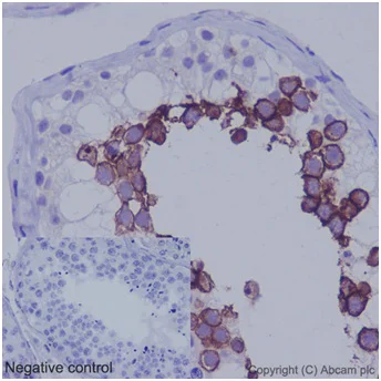 Immunohistochemistry (Formalin/PFA-fixed paraffin-embedded sections) - Anti-ART3 antibody [EPR7220(2)] - C-terminal (AB192870)