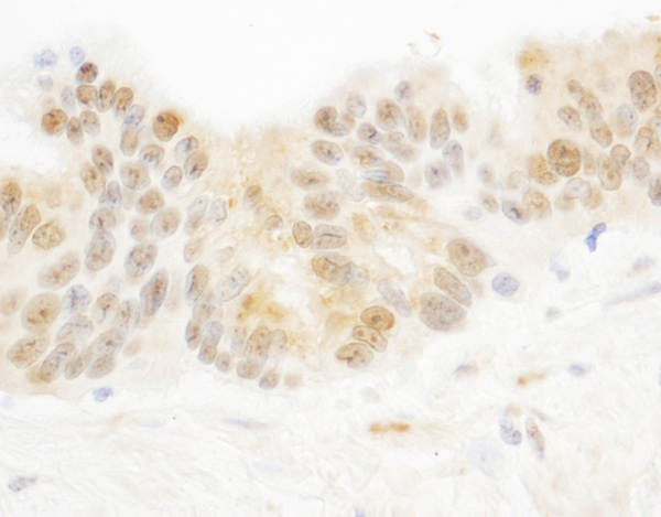 Immunohistochemistry (Formalin/PFA-fixed paraffin-embedded sections) - Anti-ARTD10 antibody (AB70800)
