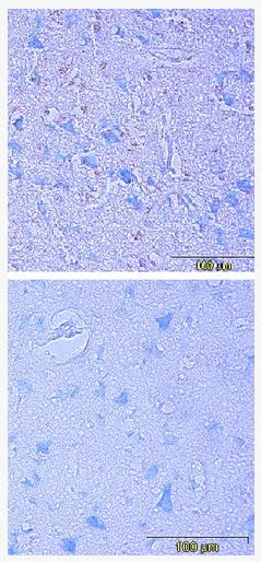 Immunohistochemistry (Formalin/PFA-fixed paraffin-embedded sections) - Anti-Artemin antibody [IF3] (AB205564)