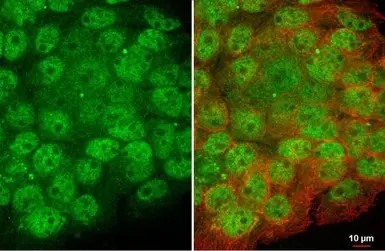 Immunocytochemistry/ Immunofluorescence - Anti-Artemis antibody [HL1227] - BSA and Azide free (AB313837), expandable thumbnail