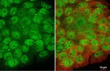 Immunocytochemistry/ Immunofluorescence - Anti-Artemis antibody [HL1227] - BSA and Azide free (AB313837)