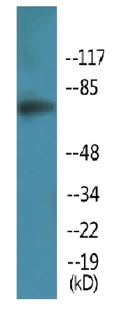 Western blot - Anti-Artemis (phospho S516) antibody (AB138411)