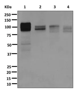 Western blot - Anti-ARVCF antibody [EPR10036(2)] (AB172633)