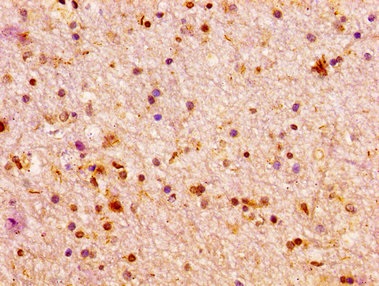 Immunohistochemistry (Formalin/PFA-fixed paraffin-embedded sections) - Anti-Arx antibody (AB235060), expandable thumbnail