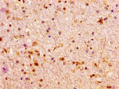 Immunohistochemistry (Formalin/PFA-fixed paraffin-embedded sections) - Anti-Arx antibody (AB235060)
