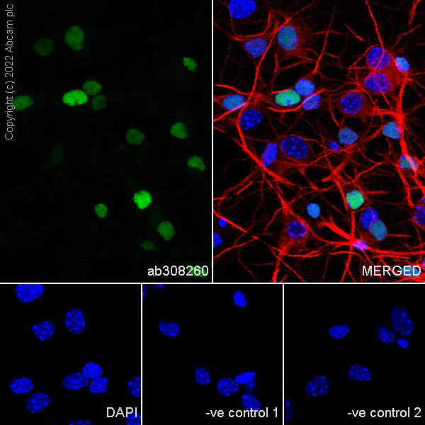 Immunocytochemistry/ Immunofluorescence - Anti-Arx antibody [EPR27481-32] (AB308260)