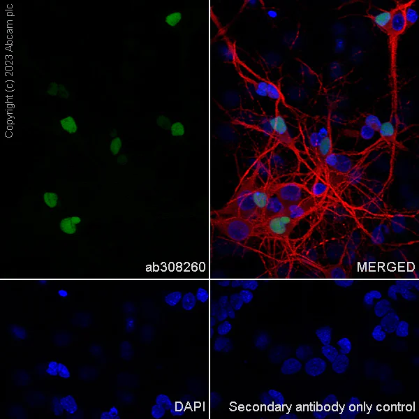 Immunocytochemistry/ Immunofluorescence - Anti-Arx antibody [EPR27481-32] (AB308260)