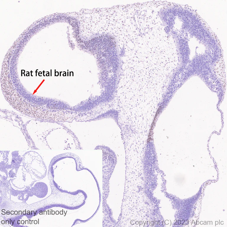 Immunohistochemistry (Formalin/PFA-fixed paraffin-embedded sections) - Anti-Arx antibody [EPR27481-32] (AB308260)