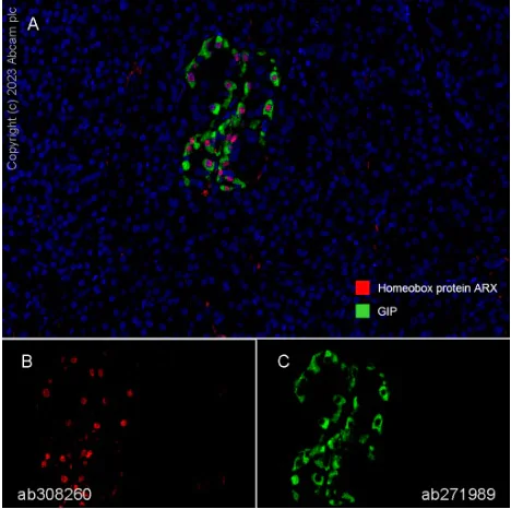 Multiplex immunohistochemistry - Anti-Arx antibody [EPR27481-32] (AB308260)