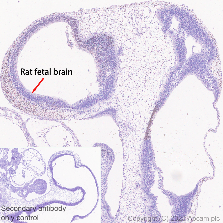 Immunohistochemistry (Formalin/PFA-fixed paraffin-embedded sections) - Anti-Arx antibody [EPR27481-32] - BSA and Azide free (ab308261), expandable thumbnail