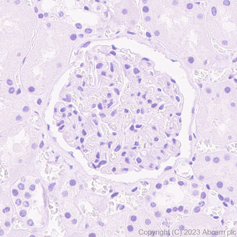 Immunohistochemistry (Formalin/PFA-fixed paraffin-embedded sections) - Anti-Arx antibody [EPR27481-32] - BSA and Azide free (AB308261)
