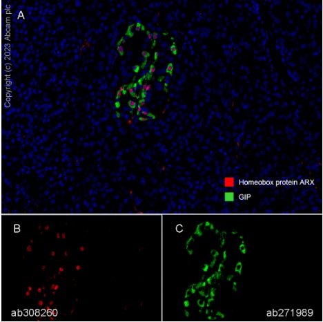 Multiplex immunohistochemistry - Anti-Arx antibody [EPR27481-32] - BSA and Azide free (AB308261), expandable thumbnail