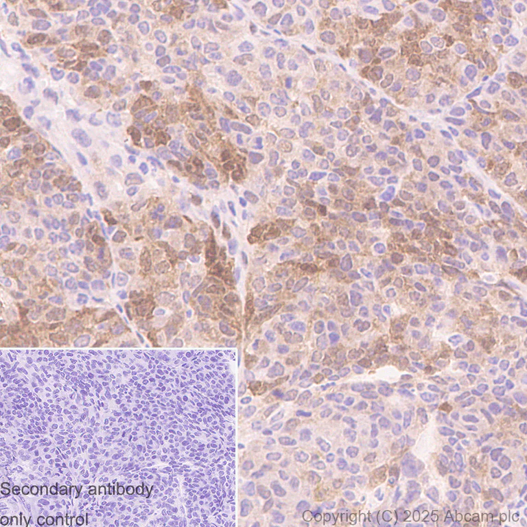Immunohistochemistry (Formalin/PFA-fixed paraffin-embedded sections) - Anti-Aryl hydrocarbon Receptor antibody [EPR27537-70] - BSA and Azide free (AB309492)