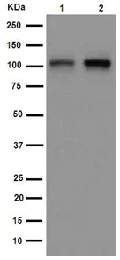Western blot - Anti-Aryl hydrocarbon Receptor antibody [EPR7119(N)(2)] (AB190797)