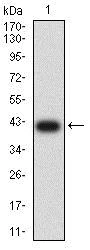 Western blot - Anti-AS160 antibody [8A11A2] (AB233784)