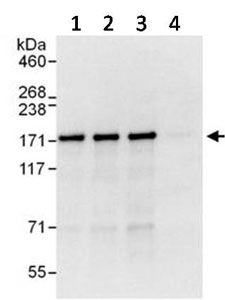 Immunoprecipitation - Anti-AS160 antibody (AB134749), expandable thumbnail