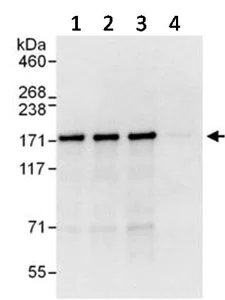 Immunoprecipitation - Anti-AS160 antibody (AB134749)