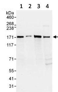Western blot - Anti-AS160 antibody (AB134749), expandable thumbnail