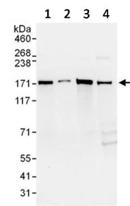 Western blot - Anti-AS160 antibody (AB134749)