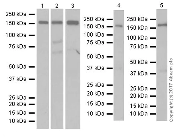 Western blot - Anti-AS160 antibody [EPR18418] (AB189890)