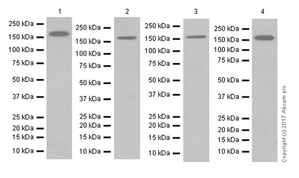 Western blot - Anti-AS160 antibody [EPR18418] (AB189890)