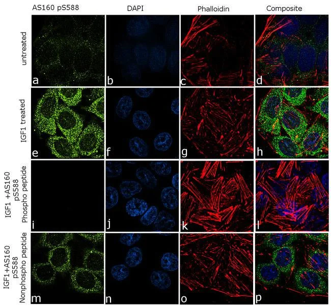 Immunocytochemistry - Anti-AS160 (phospho S588) antibody [5HCLC] (AB277781)