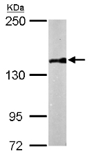 Western blot - Anti-AS3 antibody (AB153895), expandable thumbnail