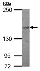 Western blot - Anti-AS3 antibody (AB153895), expandable thumbnail