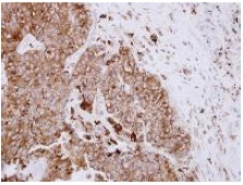 Immunohistochemistry (Formalin/PFA-fixed paraffin-embedded sections) - Anti-ASAH1 antibody (AB154401), expandable thumbnail